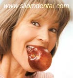 Dental Implants All-On-4, full mouth implants
