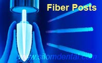 Fiber Post