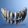 Procera® Implant Bridge Titanium