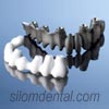 Procera® Implant Bridge