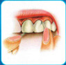 The image “http://www.silomdental.com/dental_thai/dental_tips/pic/oa7.JPG” cannot be displayed, because it contains errors.