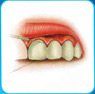 The image “http://www.silomdental.com/dental_thai/dental_tips/pic/oa8.JPG” cannot be displayed, because it contains errors.