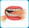 The image “http://www.silomdental.com/dental_thai/dental_tips/pic/oa9.JPG” cannot be displayed, because it contains errors.
