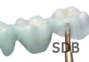 ips e max ZirCAD