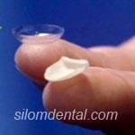 Lumineers Veneer in Bangkok dental clinic and Thailand dental clinic