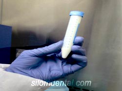 Tooth Stem Cell preservation