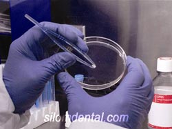 Tooth Stem Cell collection and preservation