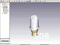 Straumann Anatomic Abutment - Fabricating the superstructure