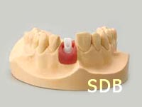 Placing the modified Straumann Anatomic IPS e.max Abutment