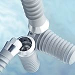 Promotion for Straumann ITI Implant in Bangkok Dental Clinic
