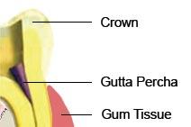 Endodontic Surgery