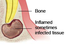 Endodontic Surgery