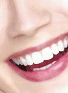 Beautiful smile by Tooth whitening