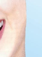 Beautiful smile by Tooth whitening