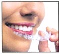 invisalign bangkok in dental orthodontics thailand