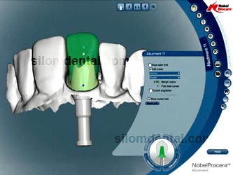 nobel procera implant abutment