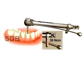 nobel procera implant bridge zirconia