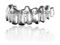 nobel procera implant bridge titanium