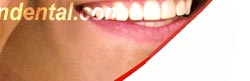 implants teeth in an hour in dental clinic Thailand