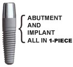 NobelDirect Dental implants