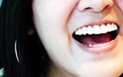 beautiful smile by oral surgery