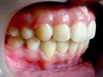 After Orthodontic treatment