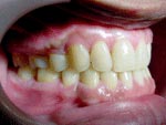 After Orthodontic treatment
