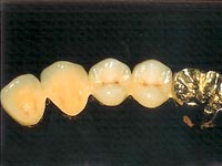 Non/Semi - Precious