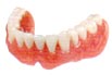 Full Denture in Dental Clinic Bangkok