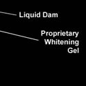 LaserSmile Whitening System