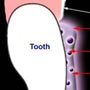 LaserSmils Whitening System