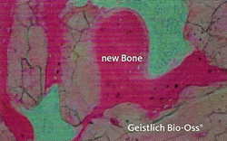 Macroporous mineral structure of human bone