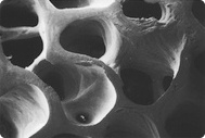 Macroporous mineral structure of Geistlich Bio-Oss