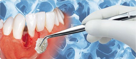 implantology