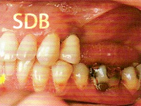 Clinical appearance preoperatively