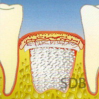 schematic representation of the vascularisation