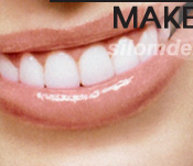 Dental Makeover