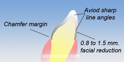 suggested preparation for Procera