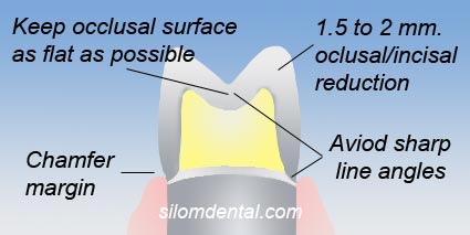 suggested preparation for Procera