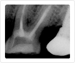 image photo x-ray from portable x-ray