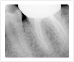 image photo x-ray from portable x-ray