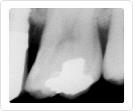 image photo x-ray from portable x-ray