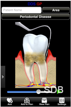 dental consultation program for ipad