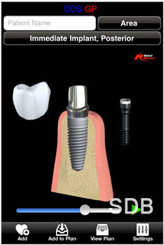 dental consultation program for ipad