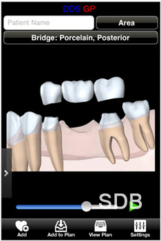 dental consultation program for ipad