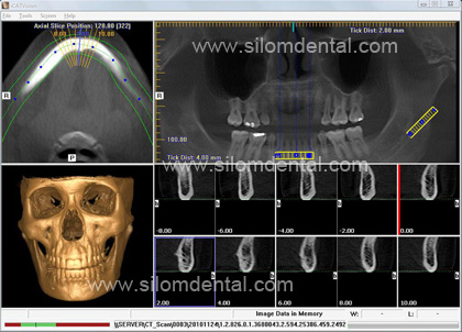 ct scan images