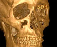 ct scan for dental tretament