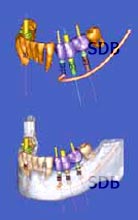 i-CAT Cone Beam 3-D Dental Imaging