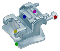 Damon bracket