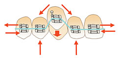 Old efficient tooth movement